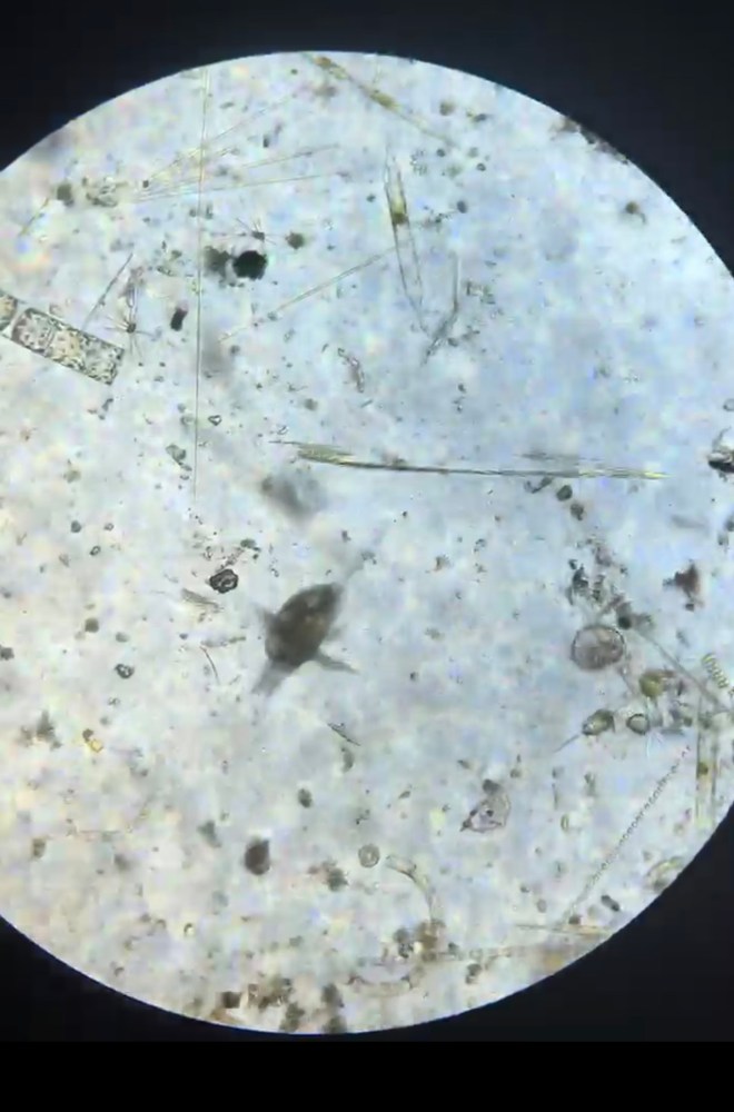 Microscopic view of various microorganisms floating on a microscope slide.